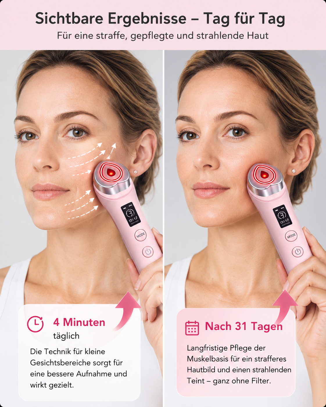LYVRA RejuvaLift™ – RF Anti-Aging Gesichtsmassagegerät
