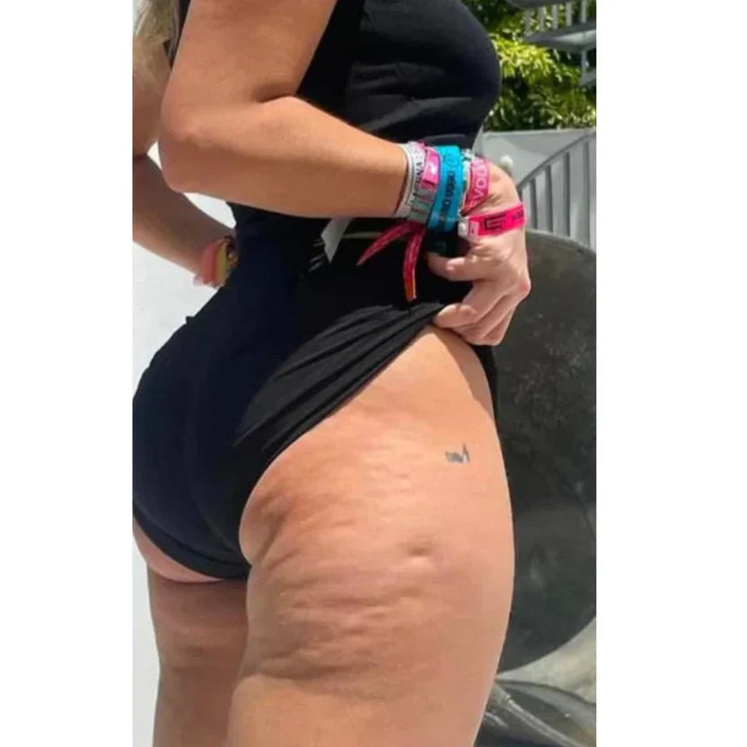 Vorher Bild mit sichtbarer Hautstruktur